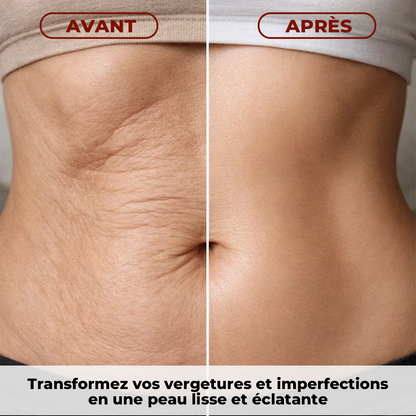 Huile Magique Anti-Cellulite 100 ml