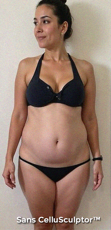 Before - Sophia