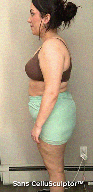 Before - Laura