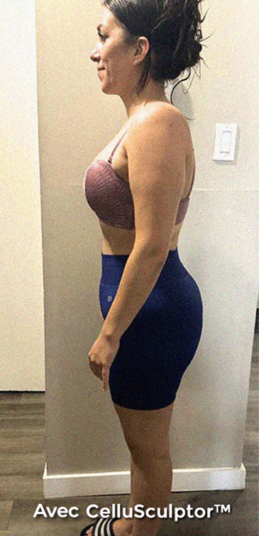 After - Laura