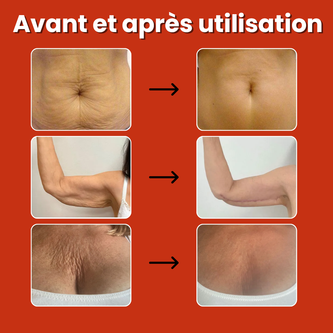Huile Magique Anti-Cellulite 100 ml